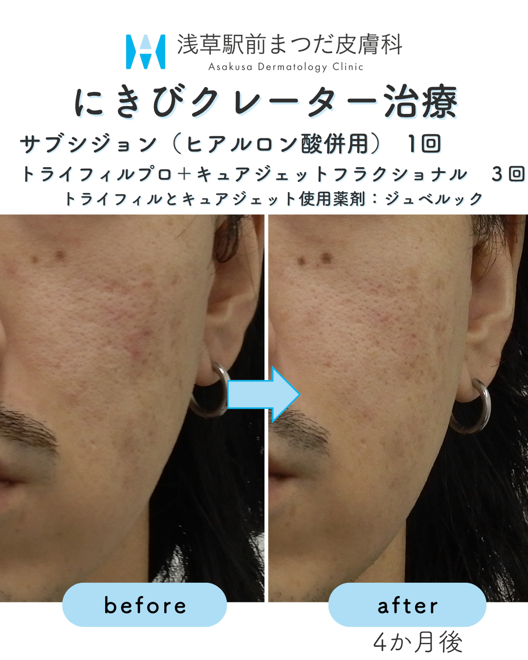 症例15
