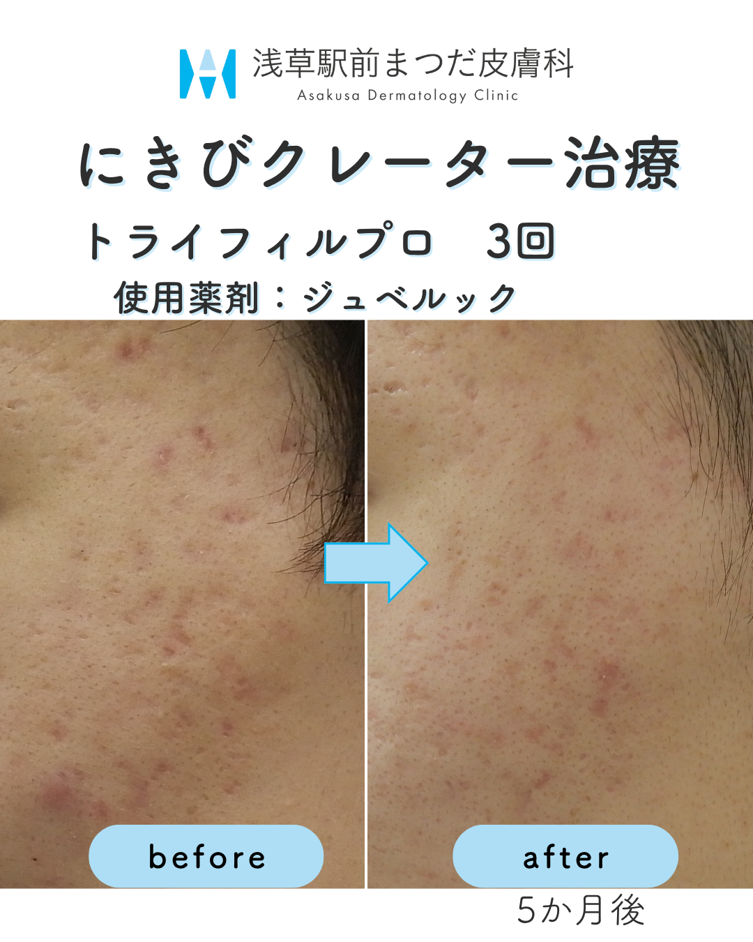 症例8