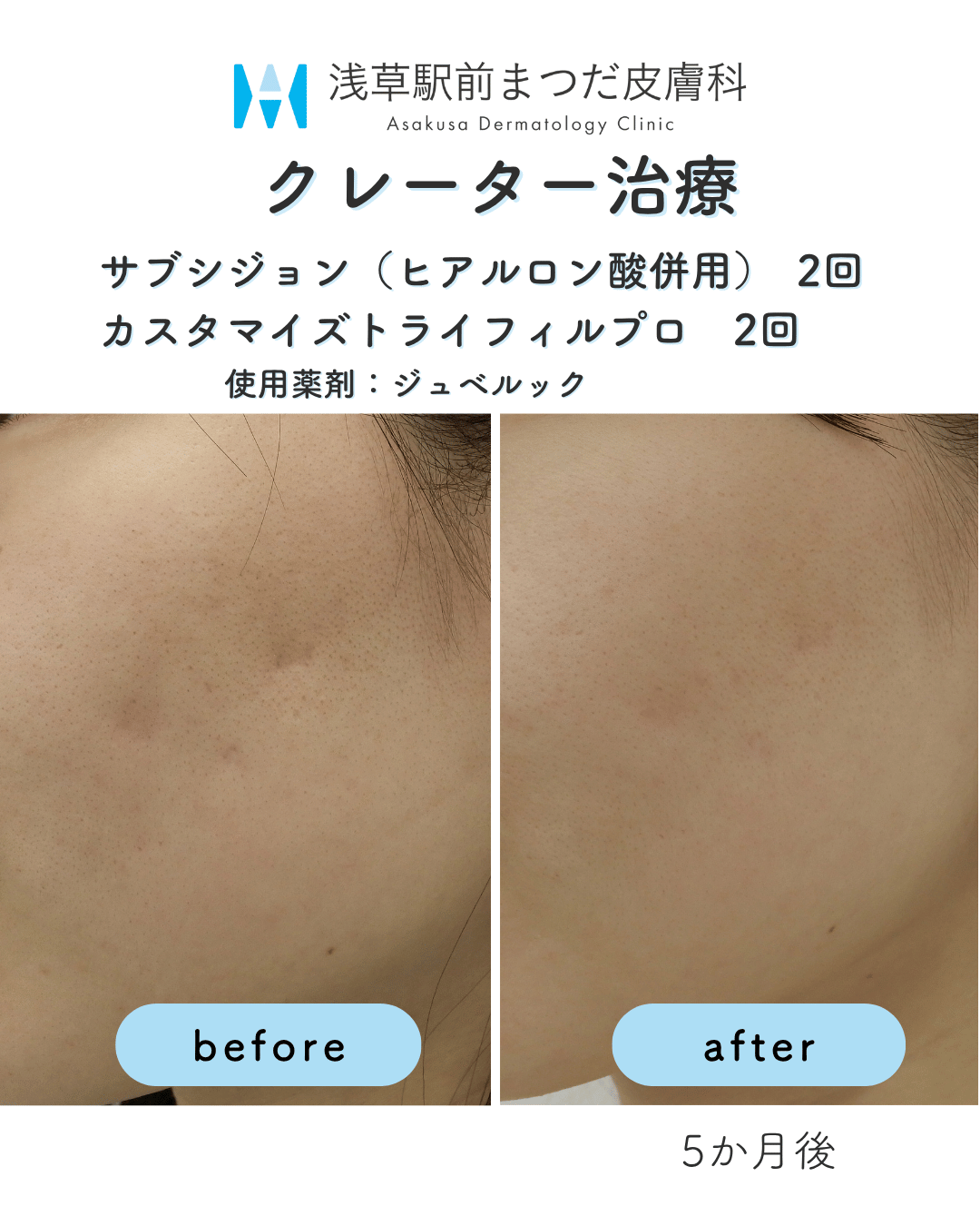 症例10